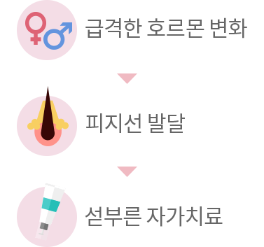 급격한 호르몬 변화 - 피지선 발달 - 섣부른 자가치료